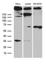 SPTAN1 Antibody in Western Blot (WB)