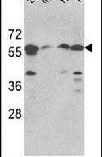 SPTLC1 Antibody in Western Blot (WB)