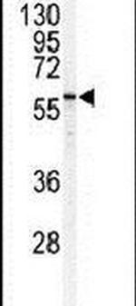 SPTLC1 Antibody in Western Blot (WB)