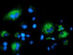 SQSTM1 Antibody in Immunocytochemistry (ICC/IF)
