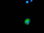 SQSTM1 Antibody in Immunocytochemistry (ICC/IF)