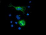 SQSTM1 Antibody in Immunocytochemistry (ICC/IF)