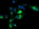 SQSTM1 Antibody in Immunocytochemistry (ICC/IF)