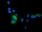 SQSTM1 Antibody in Immunocytochemistry (ICC/IF)