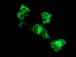 SQSTM1 Antibody in Immunocytochemistry (ICC/IF)