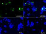SQSTM1 Antibody in Immunocytochemistry (ICC/IF)