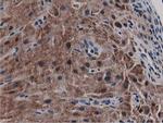 SQSTM1 Antibody in Immunohistochemistry (Paraffin) (IHC (P))