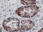SQSTM1 Antibody in Immunohistochemistry (Paraffin) (IHC (P))