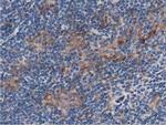 SQSTM1 Antibody in Immunohistochemistry (Paraffin) (IHC (P))