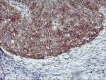 SQSTM1 Antibody in Immunohistochemistry (Paraffin) (IHC (P))