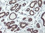 SQSTM1 Antibody in Immunohistochemistry (Paraffin) (IHC (P))