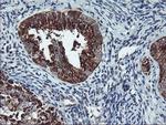 SQSTM1 Antibody in Immunohistochemistry (Paraffin) (IHC (P))