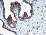 SQSTM1 Antibody in Immunohistochemistry (Paraffin) (IHC (P))