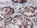SQSTM1 Antibody in Immunohistochemistry (Paraffin) (IHC (P))