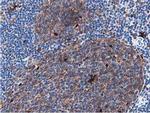 SQSTM1 Antibody in Immunohistochemistry (Paraffin) (IHC (P))