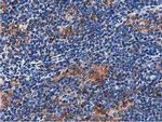 SQSTM1 Antibody in Immunohistochemistry (Paraffin) (IHC (P))