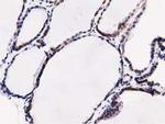 SQSTM1 Antibody in Immunohistochemistry (Paraffin) (IHC (P))