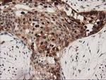 SQSTM1 Antibody in Immunohistochemistry (Paraffin) (IHC (P))