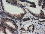 SQSTM1 Antibody in Immunohistochemistry (Paraffin) (IHC (P))