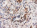 SQSTM1 Antibody in Immunohistochemistry (Paraffin) (IHC (P))