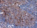 SQSTM1 Antibody in Immunohistochemistry (Paraffin) (IHC (P))