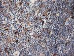 SQSTM1 Antibody in Immunohistochemistry (Paraffin) (IHC (P))