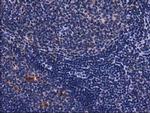 SQSTM1 Antibody in Immunohistochemistry (Paraffin) (IHC (P))