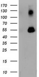 SQSTM1 Antibody in Western Blot (WB)