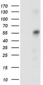 SQSTM1 Antibody in Western Blot (WB)