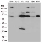 SQSTM1 Antibody in Western Blot (WB)