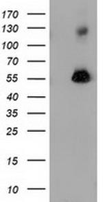 SQSTM1 Antibody in Western Blot (WB)