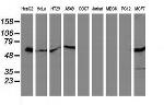SQSTM1 Antibody in Western Blot (WB)