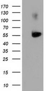 SQSTM1 Antibody in Western Blot (WB)
