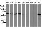 SQSTM1 Antibody in Western Blot (WB)