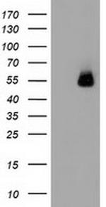 SQSTM1 Antibody in Western Blot (WB)