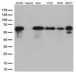 SQSTM1 Antibody in Western Blot (WB)