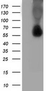SQSTM1 Antibody in Western Blot (WB)