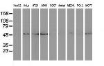 SQSTM1 Antibody in Western Blot (WB)