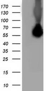 SQSTM1 Antibody in Western Blot (WB)