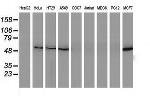 SQSTM1 Antibody in Western Blot (WB)