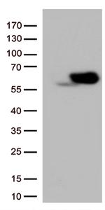 SQSTM1 Antibody in Western Blot (WB)