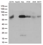 SQSTM1 Antibody in Western Blot (WB)