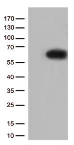 SQSTM1 Antibody in Western Blot (WB)