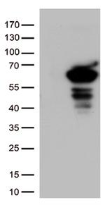 SQSTM1 Antibody in Western Blot (WB)