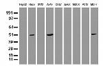 SQSTM1 Antibody in Western Blot (WB)