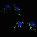 SQSTM1 Antibody in Immunocytochemistry (ICC/IF)