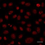 Human IgG/Rabbit IgG VHH Secondary Antibody in Immunocytochemistry (ICC/IF)