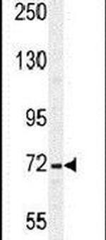 SRBD1 Antibody in Western Blot (WB)