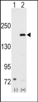 SRC1 Antibody in Western Blot (WB)