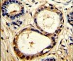 Cortactin Antibody in Immunohistochemistry (IHC)